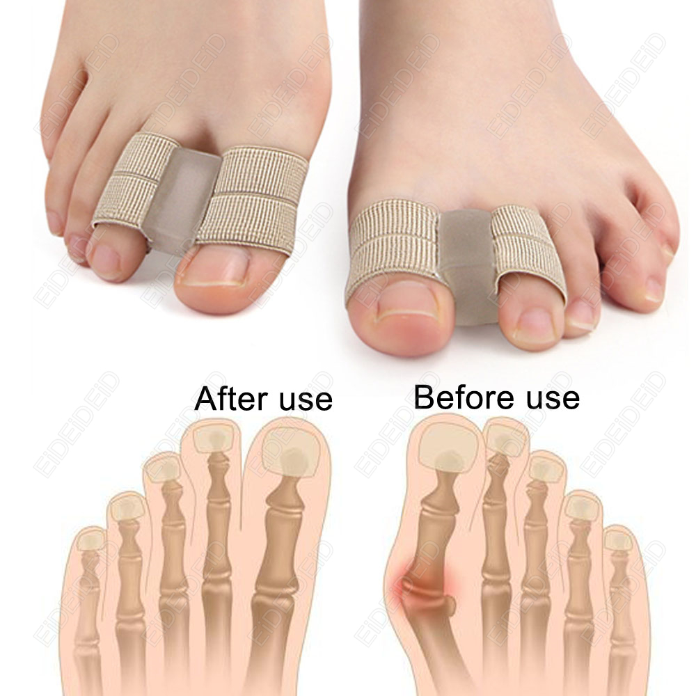 Bunion toe Corrector Orthotics - Women'S Shoes With Bunions review and price